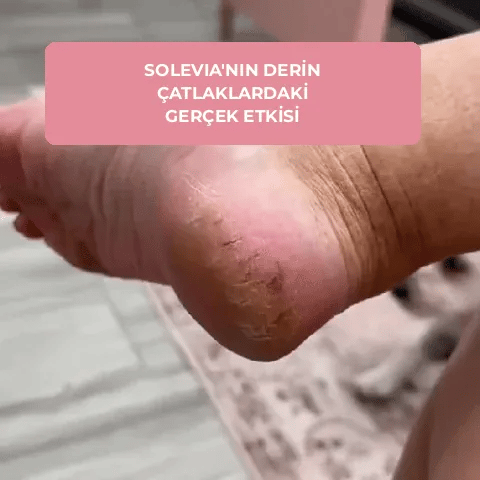 ✨ Solevia™ – Ayak Bakım Kiti
