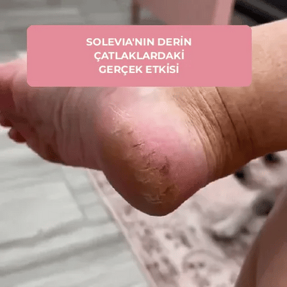 ✨ Solevia™ – Ayak Bakım Kiti
