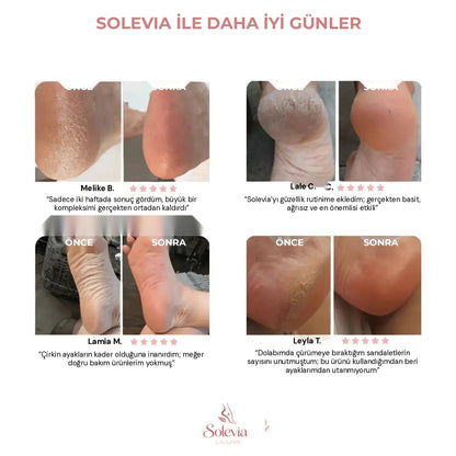 ✨ Solevia™ – Ayak Bakım Kiti